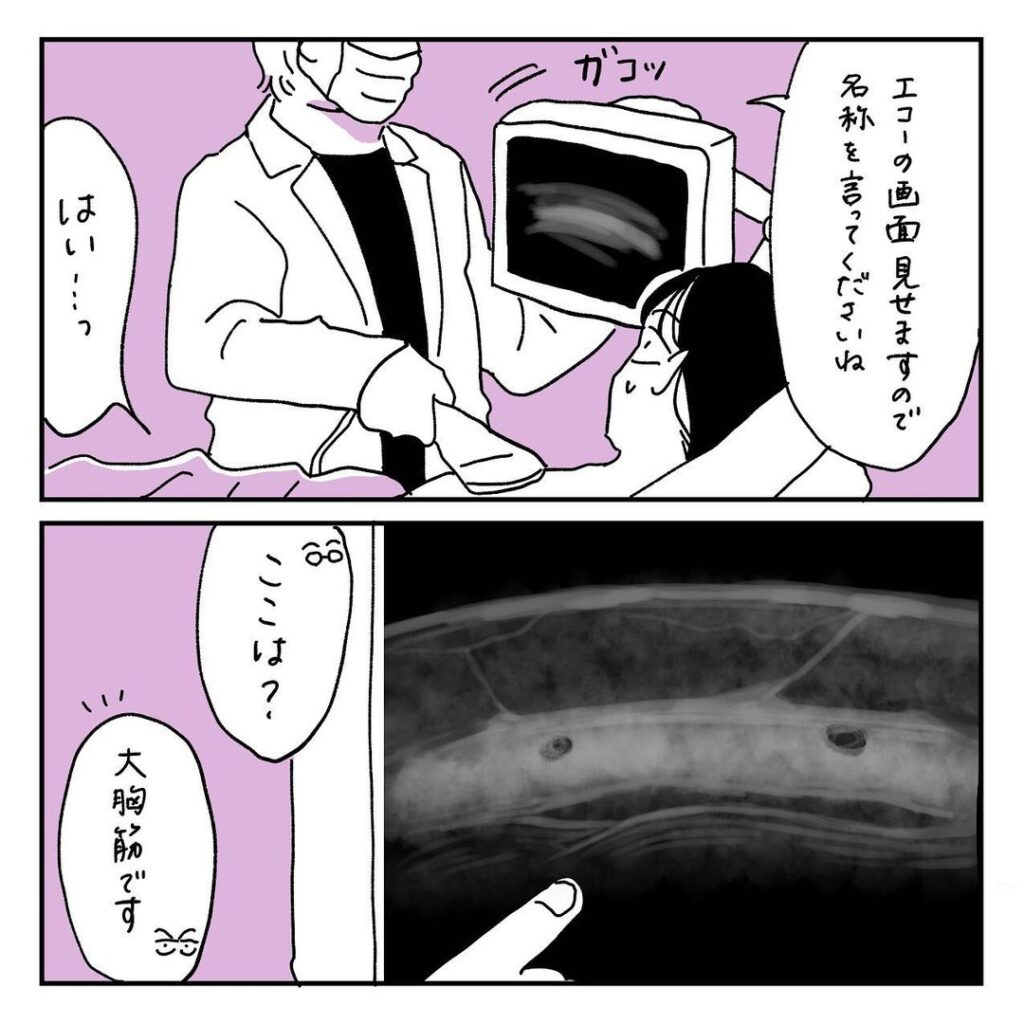 無修正　マンモグラフ　おっぱい 